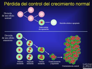 Cancer gov-espanol Que es cancer
